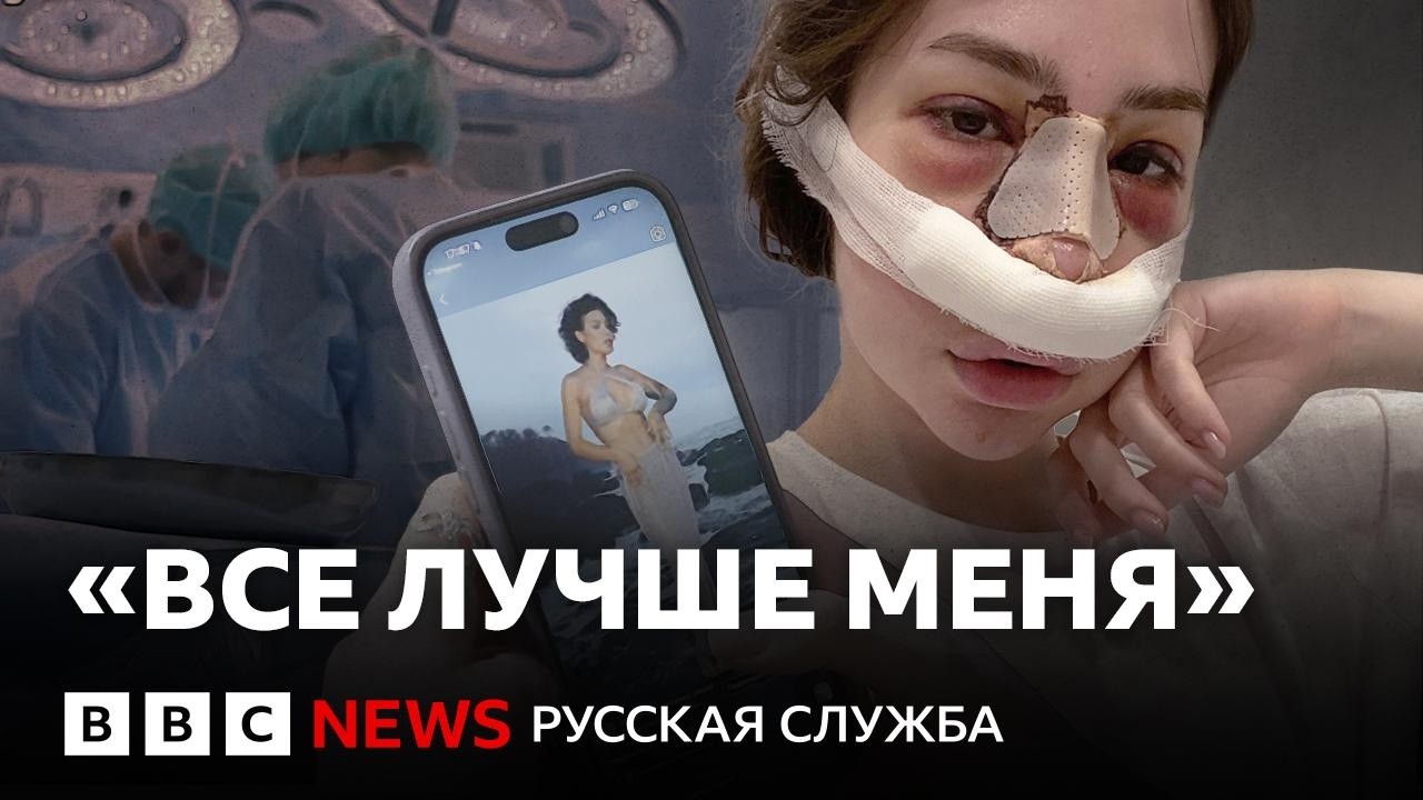 Бум «пластики» у подростков? Зачем молодые девушки идут к хирургам и какие у 