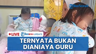 LIVE: Siswi SD di Palembang yang Alami Mata Memar dan Merah Ternyata Bukan Dianiaya