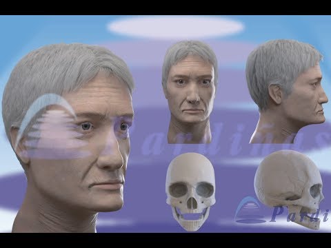 牙列缺损和骨质吸收 ©