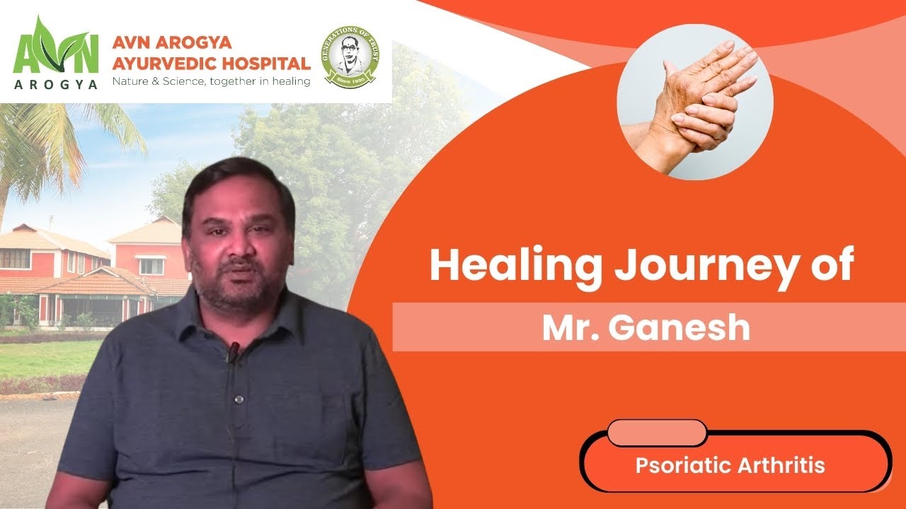 Psoriatic Arthritis Treatment From AVN Arogya (www.avnarogya.in)