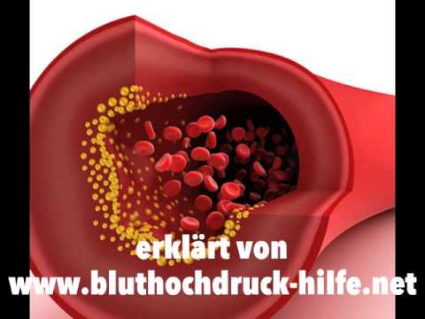 Unwirksame Behandlung von Bluthochdruck Jugend Prävention von Hypertonie