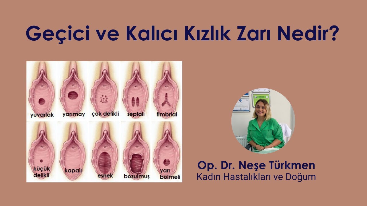 Geçici ve Kalıcı Kızlık Zarı Nedir?