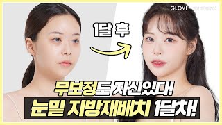 글로비지테라안티에이징의원 \u0026 스타힐링 사용 후기