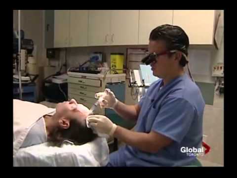 NeoGraft Hair Transplant Procedure on GlobalTV Toronto | SpaMedicaTV
