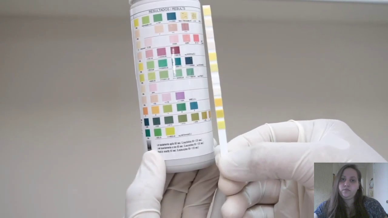 Exame químico urina