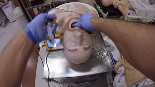 CoPilot Video Laryngoscope with Copilot Stylet. Supine Coffin Position.