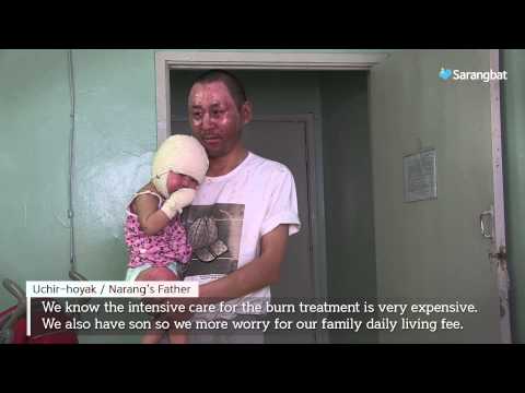 Support 32 burned Children in Mongolia