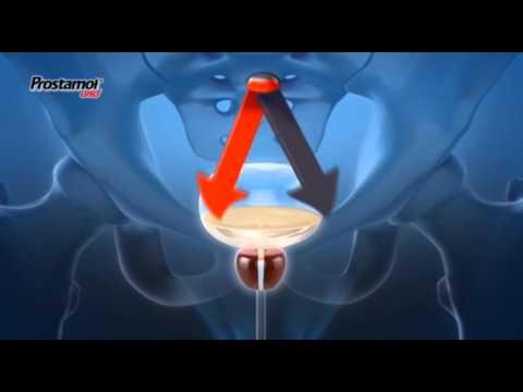Witze über Prostata Impaza helfen mit Prostatitis