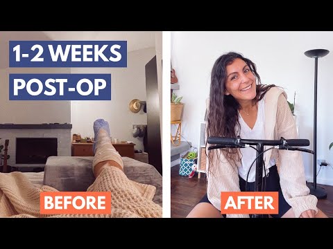 Achilles Tendon Rupture | 1-2 WEEKS post op, managing pain, showering, and the knee scooter – Part 5