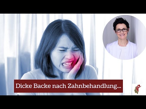 Dicke Backe nach Zahnbehandlung...