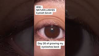 Growing my lashes back after I pulled them out #trichotillomania #lashserum #naturabeauty