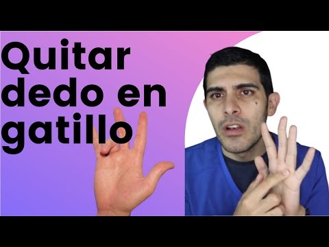 How to get rid of trigger finger with physical therapy