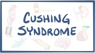 Download Lagu Cushing Syndrome - causes, symptoms, diagnosis, treatment, pathology Thumbnail
