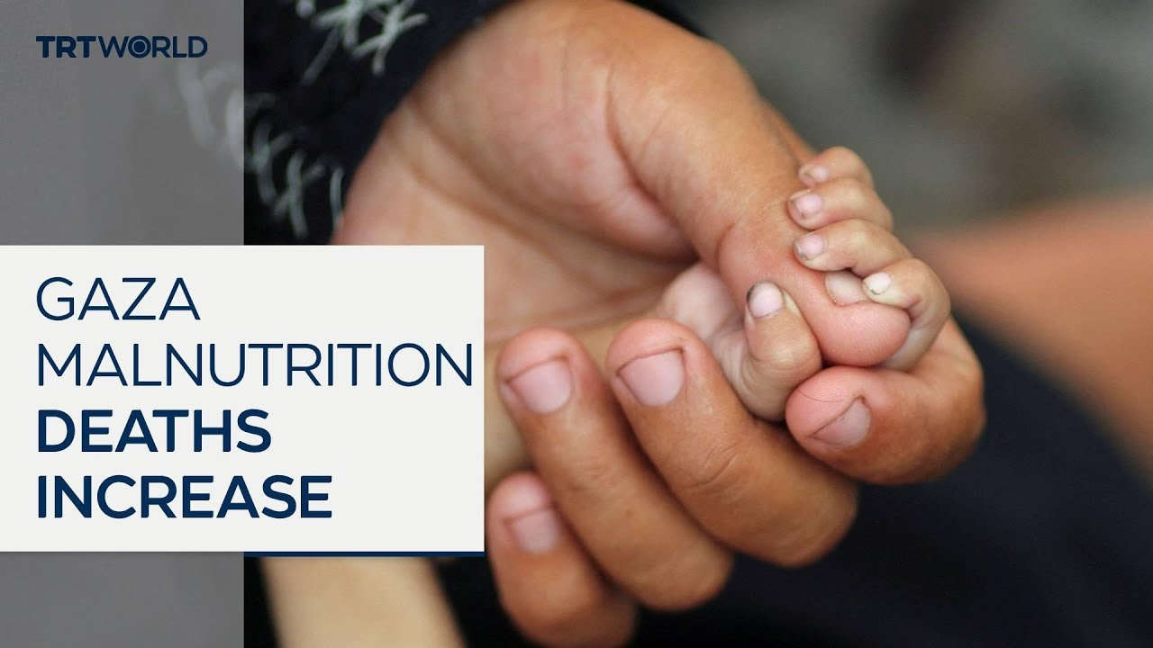 Malnutrition-linked deaths mount in Gaza Strip