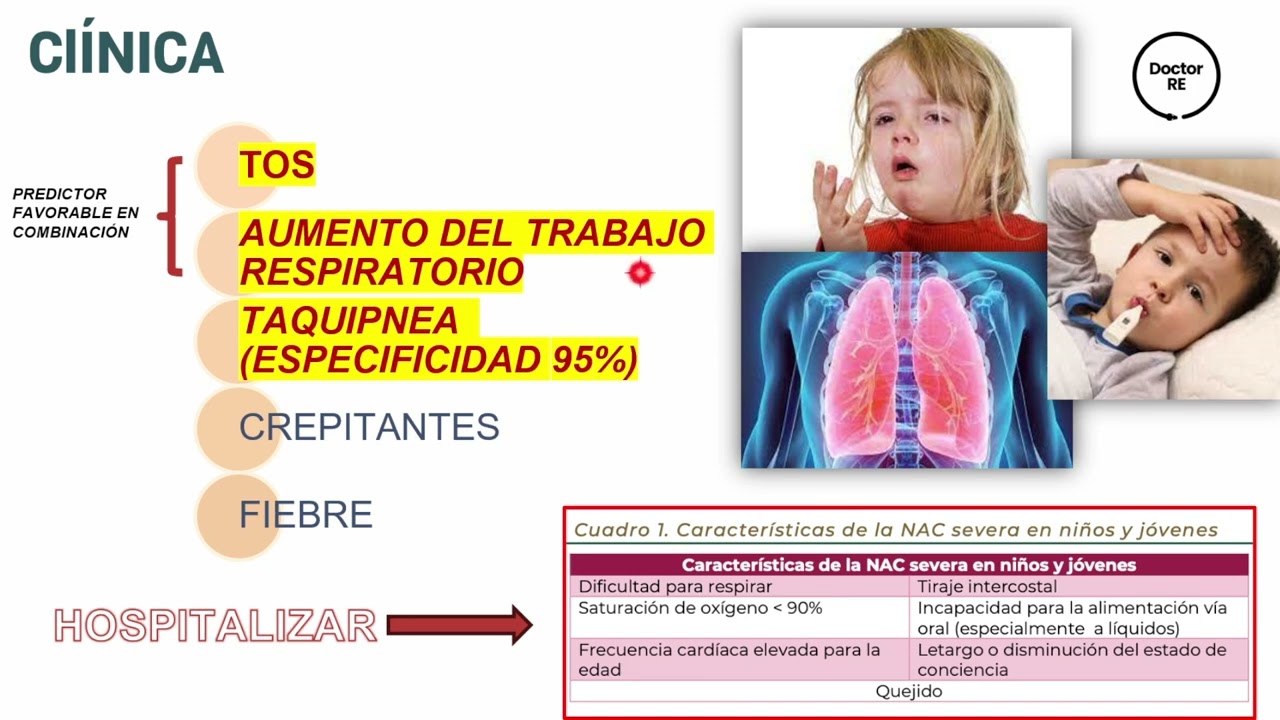 NEUMONIA ADQUIRIDA EN LA COMUNIDAD PACIENTE PEDIATRICO. ENARM GPC PEDIATRIA