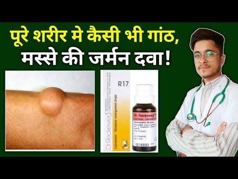 R17 Homeopathic Medicine uses in Hindi | Ganth ki Homeopathic Dawa | Tumor