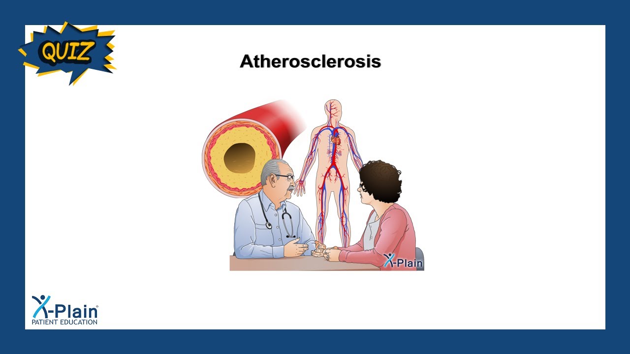 Atherosclerosis - Quiz