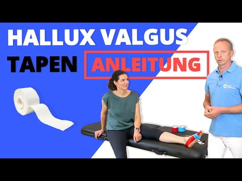 Hallux Valgus Tapen | Schritt für Schritt Anleitung (vom Physio) | Großer Zeh tapen (Ballenzeh)