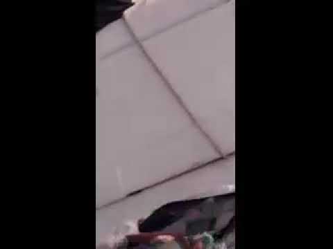 ALWAYS wear EYE PROTECTION, especially on BOAT! Thank You Peggy. ALWAYS wear EYE PROTECTION, especially on BOAT! Thank You Peggy.