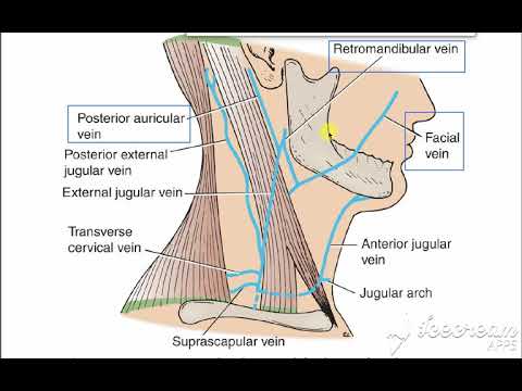 External jugular vein revision