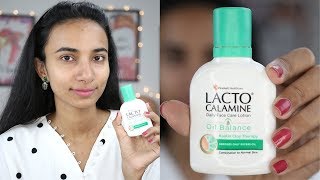 Lacto Calamine Uses [Hindi] |Get Clear, Glowing,Pimple Free Skin