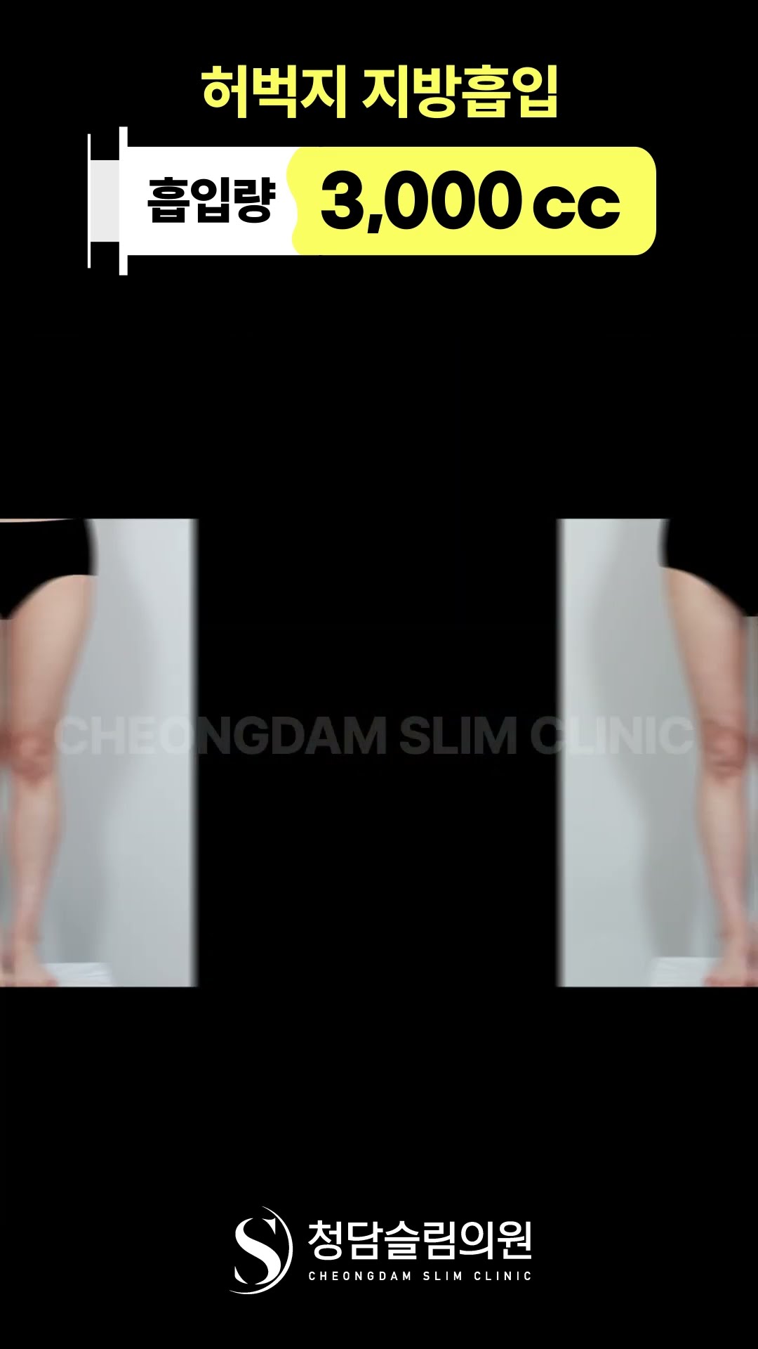 다리 짧아 보이는 진짜 이유는 이거 …