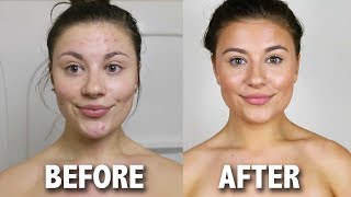 ST. MORIZ FAST TAN  |  SUNLESS/SELF TANNING ROUTINE