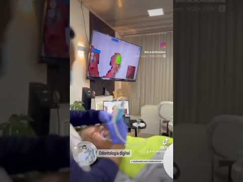 Odontología digital Santa Marta con el Odontólogo Albeiro García - Digital Dentistry