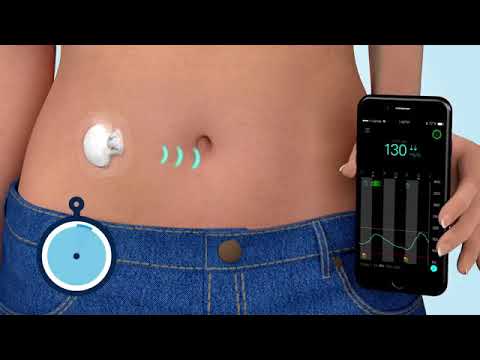 What is Continuous Glucose Monitoring (CGM)