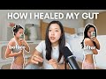 How Fixing My GUT HEALTH Changed My Life Bloating Acne Fatigue