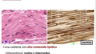 Tejido nervioso 2: Fibra mielina lesión - Neurobiología