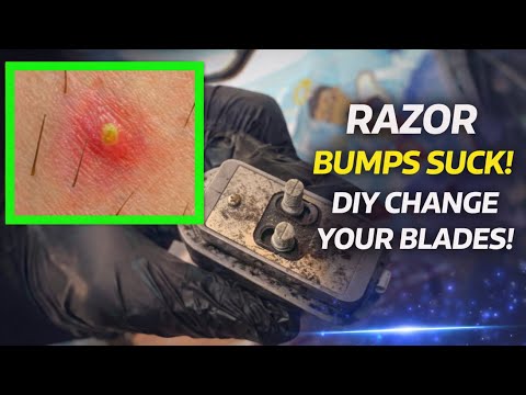 Razor bumps suck! DIY change your blades!