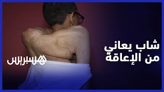 عبد الصمد.. شاب يعاني من تشوه خلقي يحكي معاناته مع الإعاقة ويطلب المساعدة thumbnail