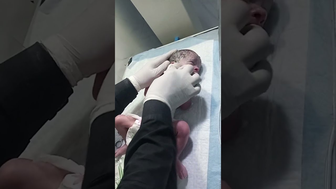 Newborn Baby Assessment Step by Step | Neonatal Examination Guide for Nurses 👶🩺