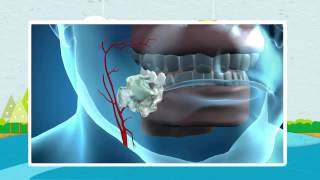 How Nicorette Works