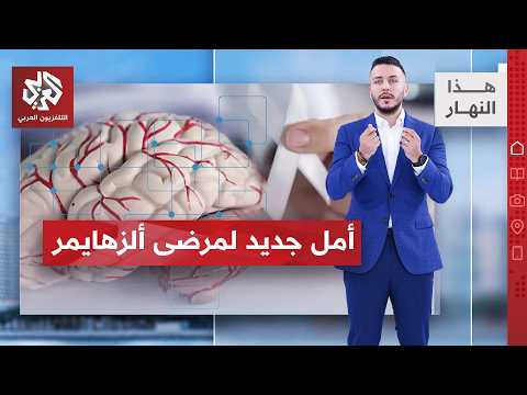 علاج مرض ألزهايمر