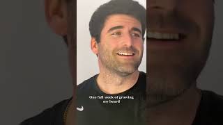 Download lagu One week of growing my beard #beard mp3 Download lagu One week of growing my beard #beard mp3