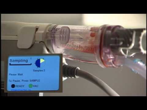 SenoRx EnCor ® Stereotactic Vacuum Assisted Biopsy