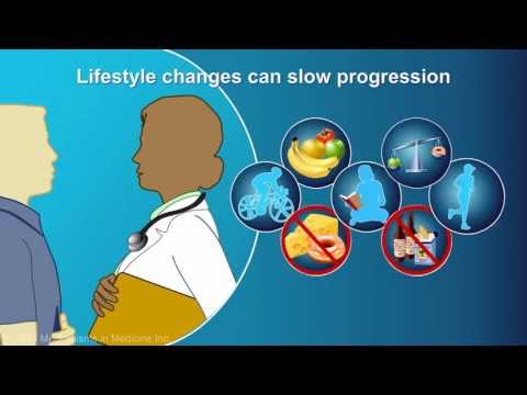 Management and Treatment of Chronic Pancreatitis