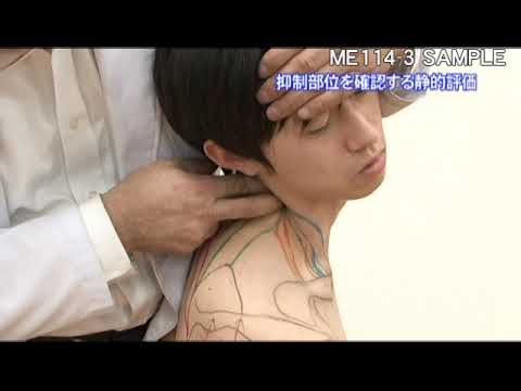 ビゴレキシア：それは何なのか、原因、症状、治療法