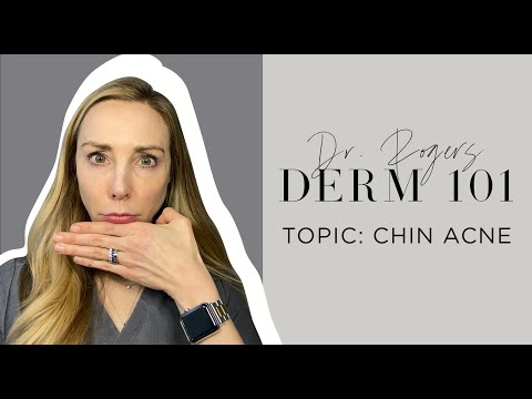 Chin Acne: Causes, Treatment, and Prevention Tips | Dermatologist's Guide