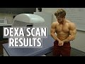 What's My Bodyfat Percentage? | POSING Update | Training Cues to Target Lats