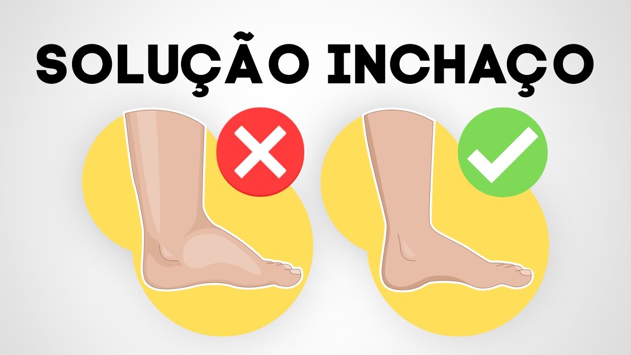 EXERCÍCIOS MÁGICOS PARA DESINCHAR AS PERNAS | Perfeito pernas inchadas
