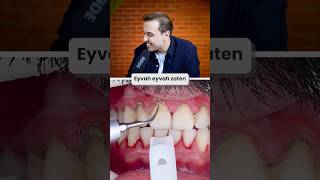 DİŞ TAŞLARI BÖYLE ÇIKIYOR !