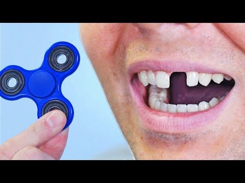 FIDGET SPINNER TOY ACCIDENT! Video