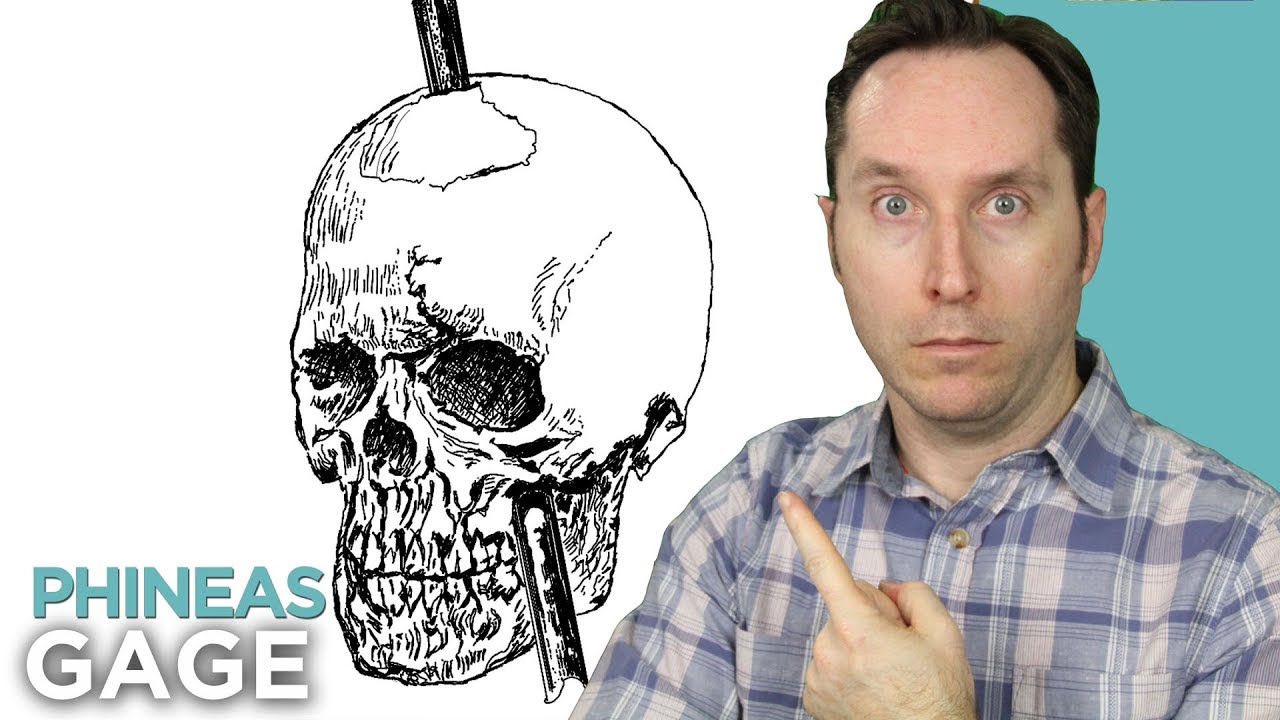 Phineas Gage And The (Literally) Mind-Blowing History Of Brain Science | Random Thursday