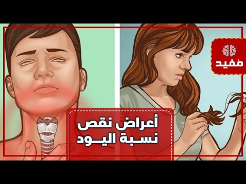 أعراض وجود نقص في نسبة اليود والتي يجب تعويضها للحفاظ على الصحة