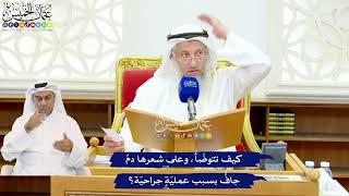 544 - كيف تتوضّأُ، وعلى شعرها دمٌ جافٌّ بسبب عمليّةٍ جراحيّة؟ - عثمان الخميس