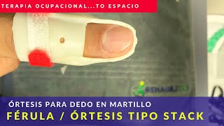 Ortesis stack para dedo en martillo, Pasó a paso de cómo realizar esta Órtesis.