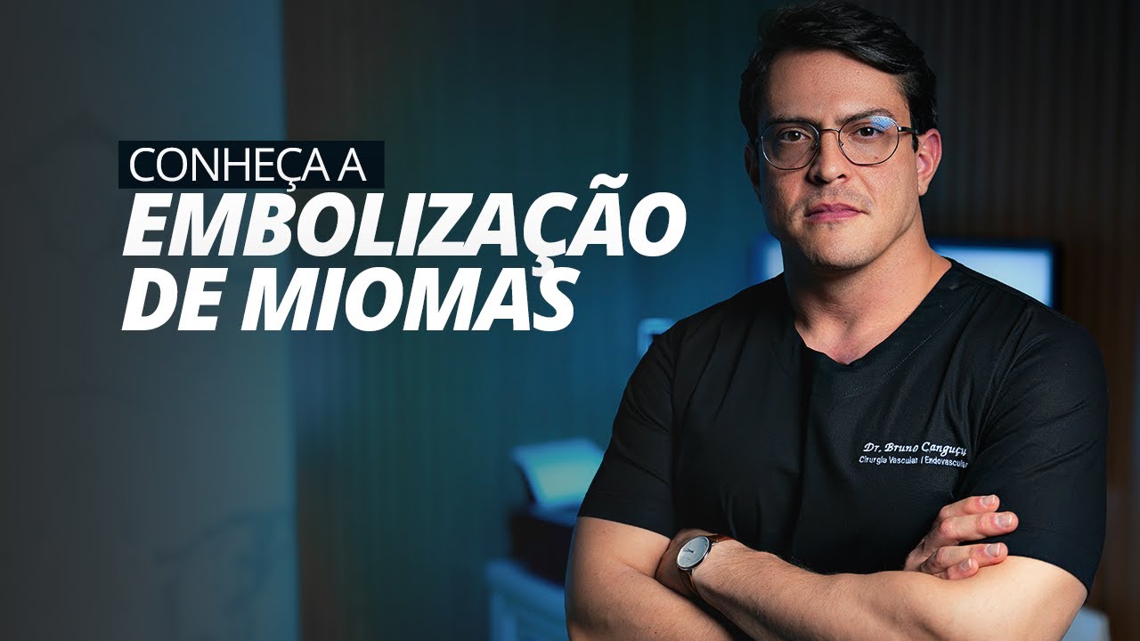 Embolização de Miomas Uterinos